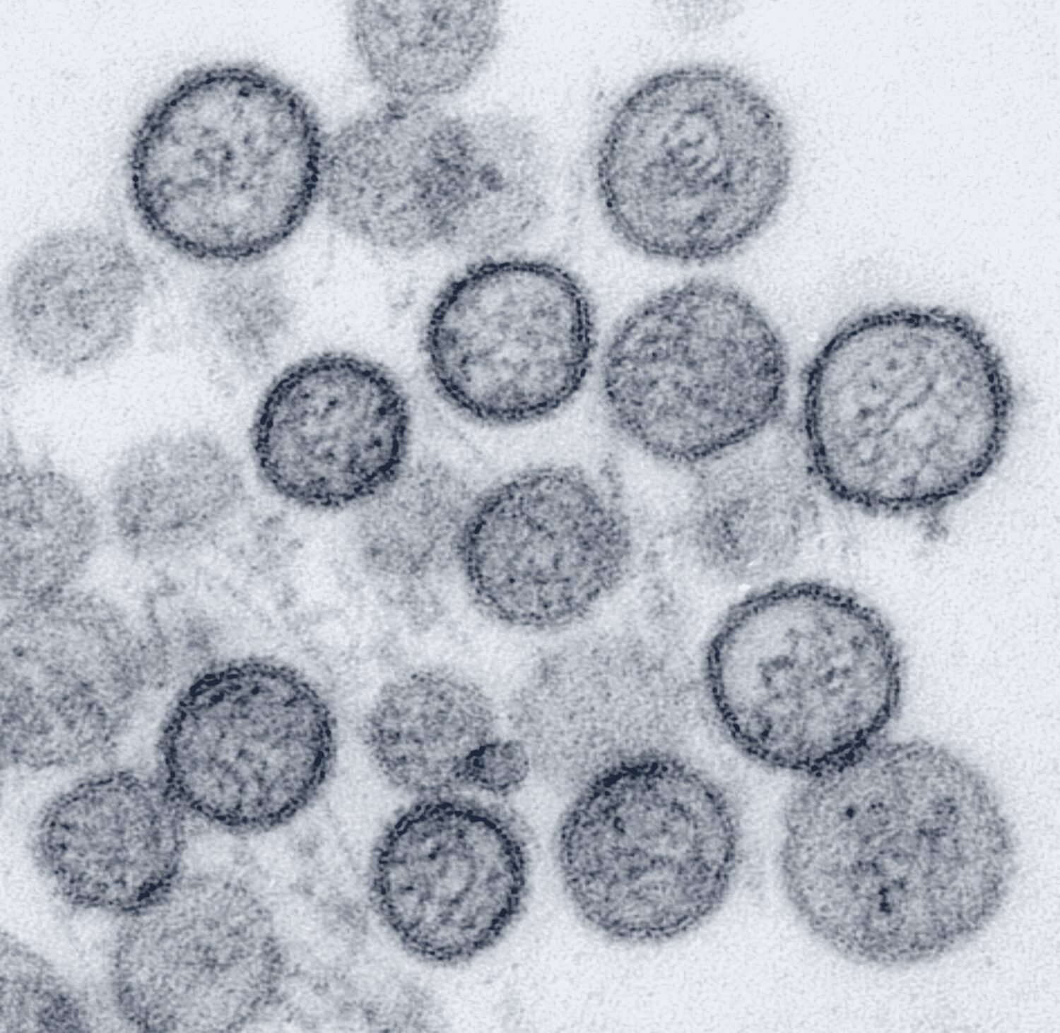 Figure illustrating making viral kinetics a pillar of surveillance